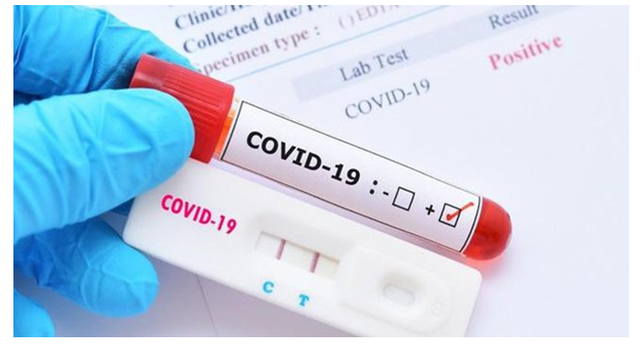 Cảnh Báo: 83% Mẫu COVID-19 Tại Thành Phố Hồ Chí Minh Là Biến Chủng Mới NB.1.8.1 - Ảnh 1.