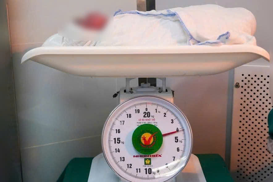 Sản phụ nặng 135 kg hạ sinh bé trai 4,1 kg - Ảnh 1.