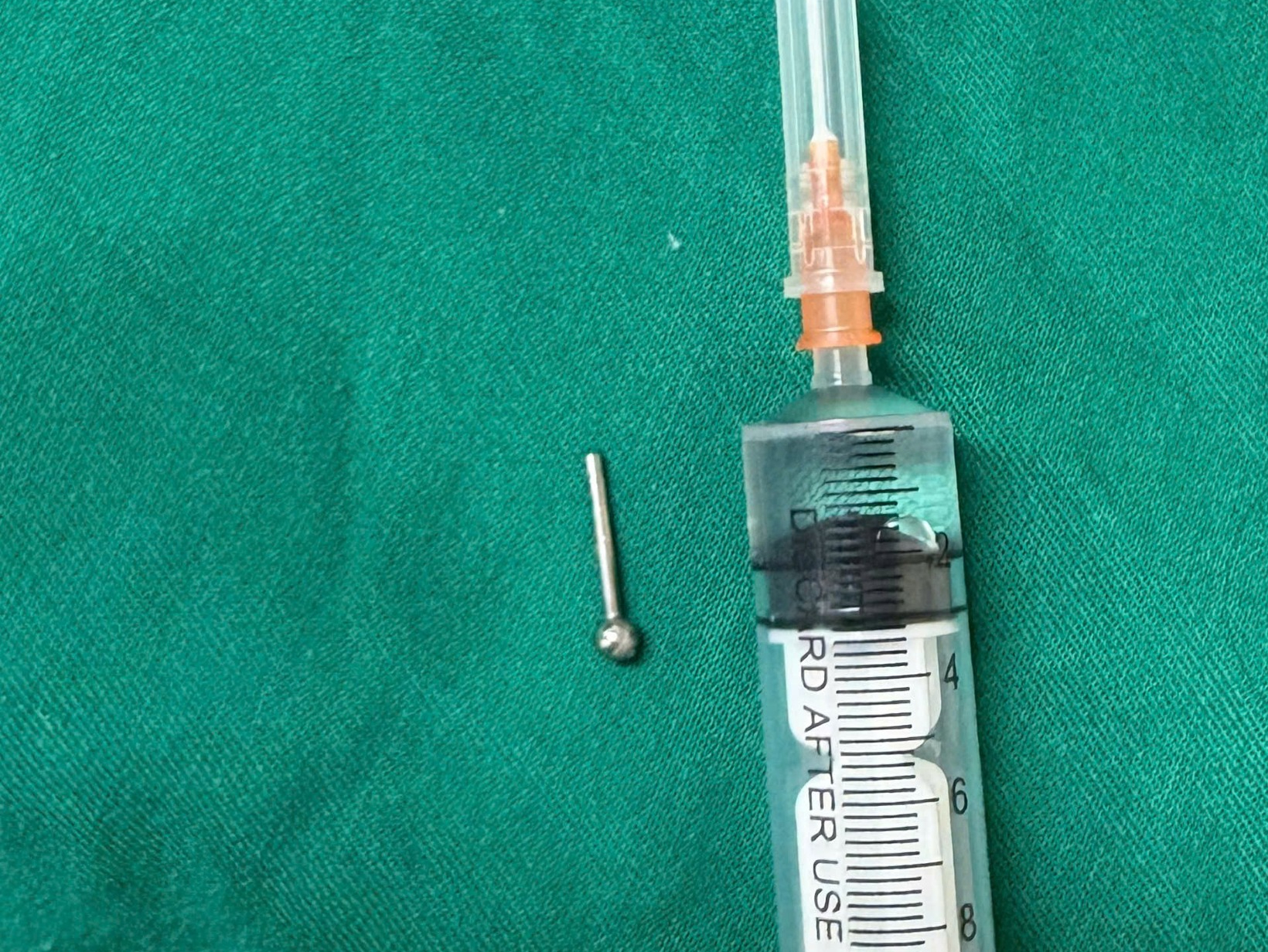 Cô gái 19 tuổi gặp sự cố với khuyên lưỡi trong lúc ăn - Ảnh 1.