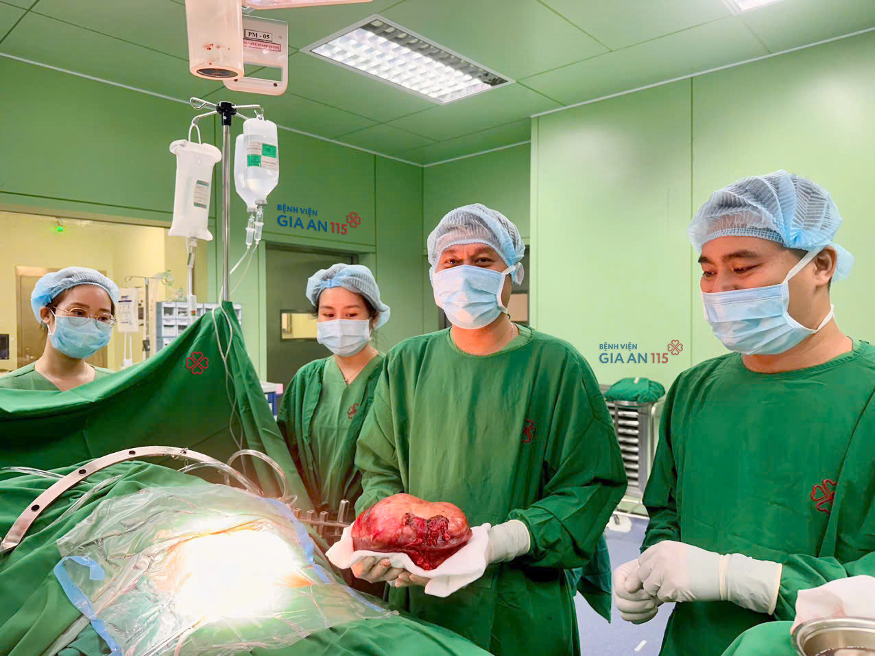 Bác sĩ bất ngờ với ca bệnh u gan khổng lồ sau 300 ca phẫu thuật - Ảnh 1.